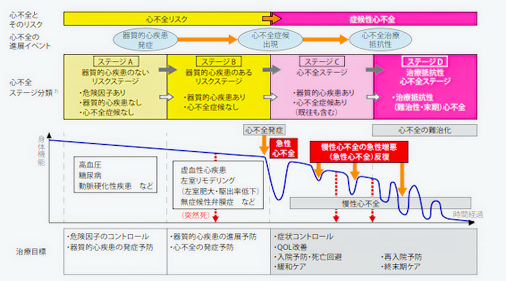 急性心不全・慢性心不全のリスクイメージ：2017年日本循環器学会ガイドラインから抜粋